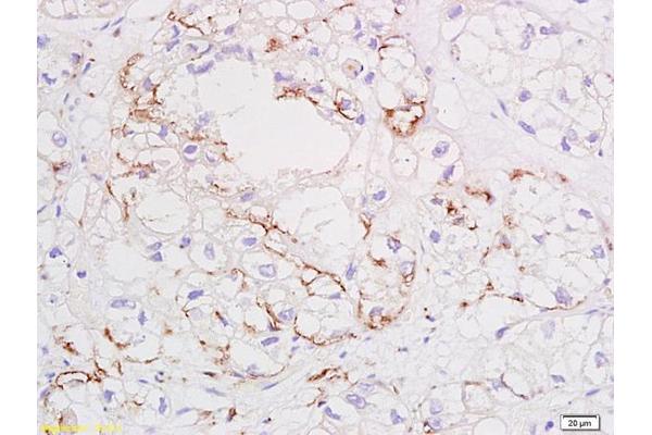 VEGF antibody