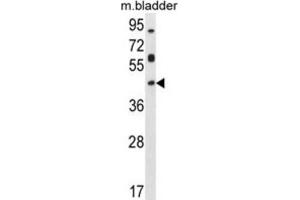 Western Blotting (WB) image for anti-Homeobox D13 (HOXD13) antibody (ABIN2996088) (Homeobox D13 antibody)