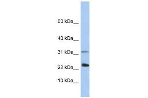 EXOSC3 antibody used at 1 ug/ml to detect target protein.