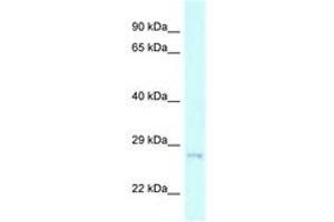 Image no. 1 for anti-Charged Multivesicular Body Protein 2A (CHMP2A) (C-Term) antibody (ABIN6747685) (CHMP2A antibody  (C-Term))