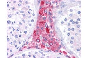 Anti-BACE1 antibody IHC of human testis. (BACE1 antibody  (N-Term))