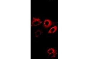 Immunofluorescent analysis of ALDH4A1 staining in A549 cells. (ALDH4A1 antibody)