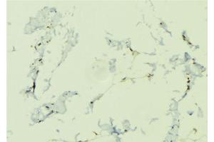 ABIN6276645 at 1/100 staining Human lung tissue by IHC-P. (NOD1 antibody  (C-Term))