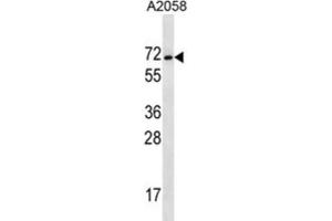 Western Blotting (WB) image for anti-Melanoma Antigen Family E, 2 (MAGEE2) antibody (ABIN2997193) (MAGEE2 antibody)