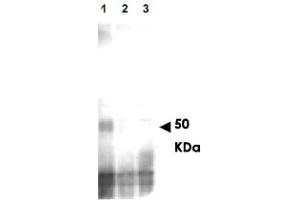 Western blot using MER2 (phospho S30) polyclonal antibody  shows detection of phos-phorylated MER2, but not phosphatase treated or mutant cells.