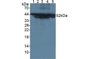 Western blot analysis of (1) Mouse Serum, (2) Mouse Intestine Tissue, (3) Mouse Pancreas Tissue, (4) Mouse Liver Tissue and (5) Human HeLa cells. (Cytokeratin 18 antibody  (AA 1-423))