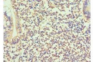 Immunohistochemistry of paraffin-embedded human small intestine tissue using ABIN7145683 at dilution of 1:100