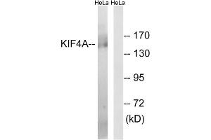 Western blot analysis of extracts from HeLa cells, using KIF4A antibody. (KIF4A antibody  (C-Term))