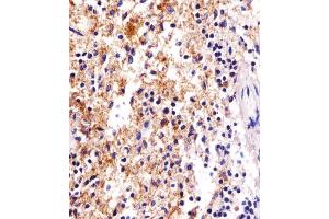 Immunohistochemical analysis of paraffin-embedded H. (FCER1G antibody  (C-Term))