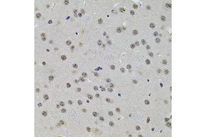Immunohistochemistry of paraffin-embedded mouse brain using SET/T antibody (ABIN6131351, ABIN6147629, ABIN6147632 and ABIN6216153) at dilution of 1:100 (40x lens). (SET/TAF-I antibody  (AA 146-277))