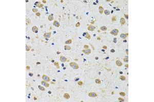 Immunohistochemistry of paraffin-embedded rat brain using EPHA2 Antibody. (EPH Receptor A2 antibody  (AA 847-976))