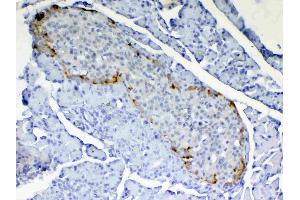 Immunohistochemistry (IHC) image for anti-Retinol Binding Protein 4, Plasma (RBP4) (AA 19-201) antibody (ABIN5519056)