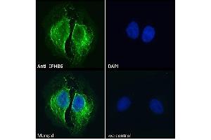 ABIN7013872 Immunofluorescence analysis of paraformaldehyde fixed U2OS cells, permeabilized with 0. (EPH Receptor B6 antibody  (Internal Region))