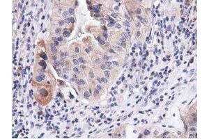 Image no. 10 for anti-COBW Domain Containing 1 (CBWD1) antibody (ABIN1497117) (CBWD1 antibody)