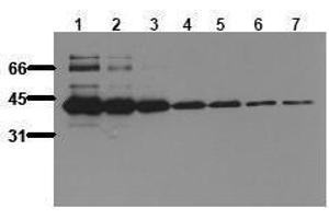 Western Blotting (WB) image for anti-MBP Tag antibody (ABIN126834) (MBP Tag antibody)