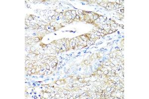 Immunohistochemistry (IHC) image for anti-Interferon alpha/beta Receptor 2 (IFNAR2) (AA 27-243) antibody (ABIN3015563)