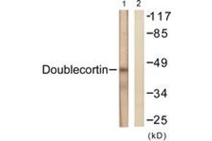 Western blot analysis of extracts from RAW264. (Doublecortin antibody  (AA 206-255))