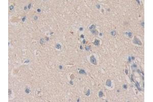 Immunohistochemistry (IHC) image for anti-Calcyclin Binding Protein (CACYBP) (AA 2-228) antibody (ABIN7434842)