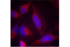 Image no. 2 for anti-Fms-Related tyrosine Kinase 3 (FLT3) (AA 589-593) antibody (ABIN401556)