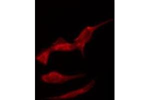 ABIN6275337 staining Hela by IF/ICC. (SLC6A15 antibody  (N-Term))
