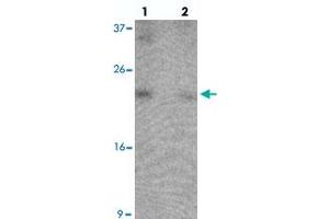 Western blot analysis of B9D1 in 293 cell lysate with B9D1 polyclonal antibody  at 1 ug/mL in (lane 1) the absence and (lane 2) the presence of blocking peptide. (B9D1 antibody  (C-Term))