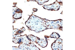 Immunohistochemistry of paraffin-embedded human placenta using NAIP Rabbit mAb (ABIN7268931) at dilution of 1:100 (40x lens). (NAIP antibody)
