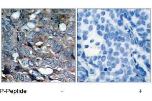 Image no. 1 for anti-Mitogen-Activated Protein Kinase Kinase Kinase 5 (MAP3K5) (pSer83) antibody (ABIN196913) (ASK1 antibody  (pSer83))