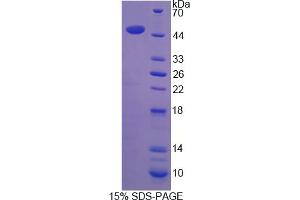 Image no. 1 for Sclerostin (SOST) (AA 25-213) protein (His tag,GST tag) (ABIN4989594) (Sclerostin Protein (SOST) (AA 25-213) (His tag,GST tag))