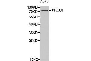 Western Blotting (WB) image for anti-X-Ray Repair Complementing Defective Repair in Chinese Hamster Cells 1 (XRCC1) (AA 1-320) antibody (ABIN6213850) (XRCC1 antibody  (AA 1-320))