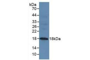 Figure. (MUC1 antibody  (AA 1098-1255))