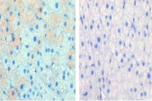 Left image is paraformaldehyde-fixed and paraffin-embedded cow lactating with CPT1A Pab , which was peroxidase-conjugated to the secondary antibody, followed by AEC staining, right image is contrast, did not add the antibody. (CPT1A antibody  (C-Term))
