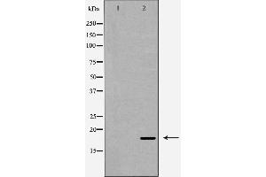 Western blot analysis of Caspase 6 (Cleaved-Asp179) expression in Hela cells. (Caspase 6 antibody  (Cleaved-Asp179))