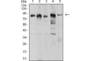 Western Blotting (WB) image for anti-Ubiquitin-Like, Containing PHD and RING Finger Domains, 1 (UHRF1) (AA 616-755) antibody (ABIN5905913)