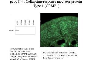 Image no. 1 for anti-Collapsin Response Mediator Protein 1 (CRMP1) (C-Term) antibody (ABIN347035) (CRMP1 antibody  (C-Term))