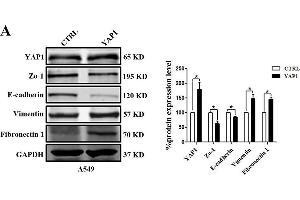 EMT-related marker expression in A549 cells with YAP1 overexpression or silencing. (GAPDH antibody)