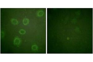 Immunofluorescence analysis of HuvEc cells, using HER2 (Phospho-Thr686) Antibody.