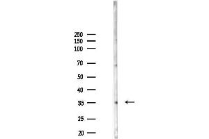 anti-Claudin 16 (CLDN16) antibody