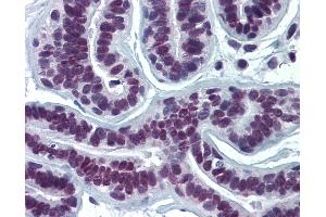 Anti-SUMO2 antibody IHC of human breast.