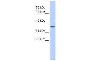 FBXO31 antibody used at 1 ug/ml to detect target protein.