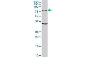 GLS monoclonal antibody (M01), clone 5C4 Western Blot analysis of GLS expression in Hela NE (Glutaminase antibody  (AA 580-669))