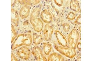 Immunohistochemistry of paraffin-embedded human kidney tissue using ABIN7158728 at dilution of 1:100 (KDM1B antibody  (AA 451-544))