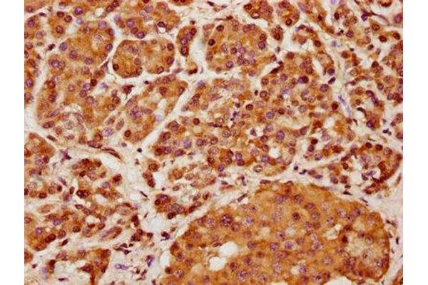 KIF13A antibody  (AA 1383-1537)