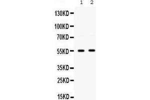 Western blot analysis of SMYD3 expression in HELA whole cell lysates (lane 1) and COLO320 whole cell lysates (lane 2). (SMYD3 antibody  (C-Term))