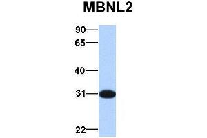 Host:  Rabbit  Target Name:  MBNL2  Sample Type:  Human Fetal Brain  Antibody Dilution:  1. (MBNL2 antibody  (Middle Region))