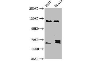 Western Blot Positive WB detected in: 293T whole cell lysate, Rat brain tissue All lanes: TCERG1 antibody at 5. (TCERG1 antibody  (AA 782-896))