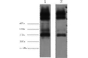 Western Blotting (WB) image for anti-EF-Hand Domain Family, Member D1 (EFHD1) antibody (ABIN5959455) (EFHD1 antibody)