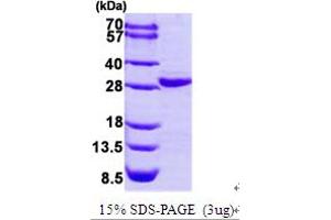 SDS-PAGE (SDS) image for Collagen, Type IV, alpha 3 (Goodpasture Antigen) Binding Protein (COL4A3BP) (AA 347-598) protein (His tag) (ABIN667012) (COL4A3BP Protein (AA 347-598) (His tag))