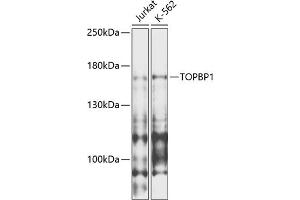 Western blot analysis of extracts of various cell lines, using TOPBP1 antibody (ABIN6134114, ABIN6149397, ABIN6149400 and ABIN6216254) at 1:1000 dilution. (TOPBP1 antibody  (AA 1-100))