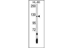 Image no. 1 for anti-Pumilio Homolog 1 (PUM1) (N-Term) antibody (ABIN360015) (PUM1 antibody  (N-Term))