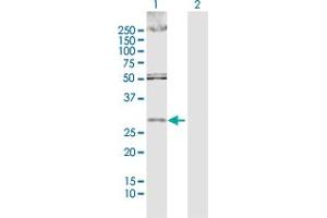 Western Blot analysis of DKK1 expression in transfected 293T cell line by DKK1 MaxPab polyclonal antibody.
